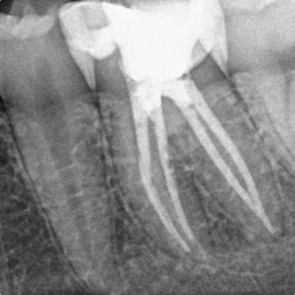 endodonzia